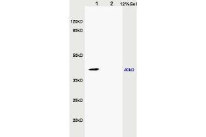 L1 rat kidney lysates L2 rat brain lysates probed with Anti ZNF379/ZDHHC9 Polyclonal Antibody, Unconjugated (ABIN715676) at 1:200 in 4 °C. (ZDHHC9 抗体  (AA 118-155))