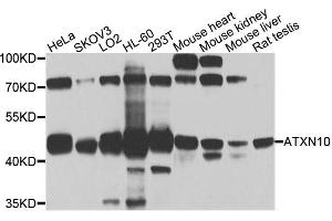 Western blot analysis of extracts of various cell lines, using ATXN10 antibody (ABIN5972628) at 1/1000 dilution. (Ataxin 10 抗体)