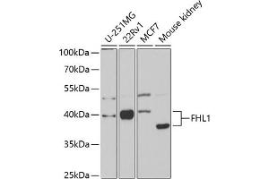 Western blot analysis of extracts of various cell lines, using FHL1 antibody (ABIN6127897, ABIN6140628, ABIN6140629 and ABIN6221119) at 1:1000 dilution. (FHL1 抗体  (AA 27-296))