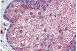 Anti-TM9SF3 antibody IHC staining of skin, sebaceous gland, human. (TM9SF3 抗体  (Internal Region))