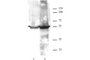 KLF4 antibody tested by Western blot. (KLF4 抗体)