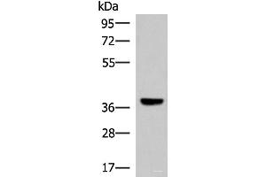 Western blot analysis of Mouse liver tissue lysate using LRG1 Polyclonal Antibody at dilution of 1:1000