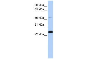 WB Suggested Anti-LYCAT Antibody Titration:  0. (LCLAT1 抗体  (Middle Region))