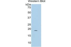 WB of Protein Standard: different control antibodies  against Highly purified E.