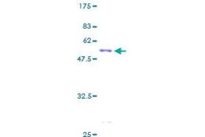 CA1 Protein (AA 1-261) (GST tag)