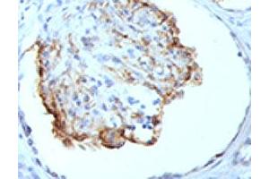 IHC testing of formalin-fixed, paraffin-embedded human kidney stained with WT1 antibody (clone WT1/857).