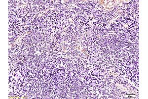 Formalin-fixed and paraffin embedded human lymph node tissue labeled with Anti-BRMS-1 Polyclonal Antibody, Unconjugated (ABIN730933) at 1:200 followed by conjugation to the secondary antibody and DAB staining