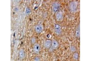 #VALUE! (GREM1 抗体  (AA 25-184))