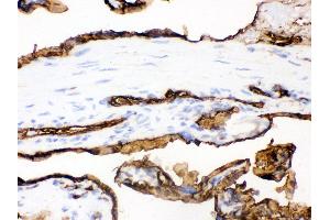 Immunohistochemistry (IHC) image for anti-Solute Carrier Family 2 (Facilitated Glucose Transporter), Member 1 (SLC2A1) (AA 92-492) antibody (ABIN3043927)