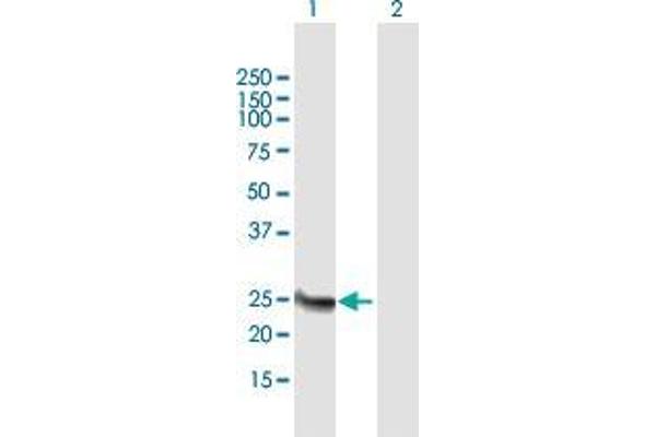 Methyltransferase Like 21B (METTL21B) (AA 1-226) antibody