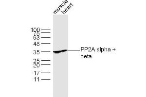 Lane 1: Muscle lysates Lane 2: Heart lysates probed with PP2A alpha + beta Polyclonal Antibody, Unconjugated  at 1:300 dilution and 4˚C overnight incubation. (PP2A alpha/beta 抗体  (AA 205-309))