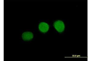 Immunofluorescence of purified MaxPab antibody to WDR45 on HeLa cell. (WDR45 抗体  (AA 1-360))