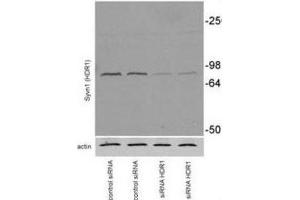 Western Blotting (WB) image for anti-Synovial Apoptosis Inhibitor 1, Synoviolin (SYVN1) antibody (ABIN2995229) (SYVN1 抗体)