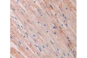 IHC-P analysis of Rat Tissue, with DAB staining. (NPPA 抗体  (AA 25-122))