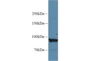 Western Blot; Sample: Human Liver lysate; Primary Ab: 1µg/ml Rabbit Anti-Human PYGL Antibody Second Ab: 0. (PYGL 抗体  (AA 633-820))