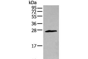 Western blot analysis of Jurkat cell using ZNF22 Polyclonal Antibody at dilution of 1:400 (Zinc Finger Protein 22 抗体)