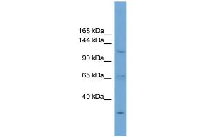 WB Suggested Anti-ZNF624 Antibody Titration: 0. (ZNF624 抗体  (N-Term))