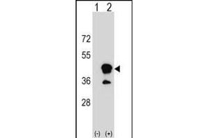 Western blot analysis of CD1B (arrow) using rabbit polyclonal CD1B Antibody (N-term) (ABIN1539475 and ABIN2849952). (CD1b 抗体  (N-Term))
