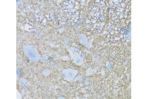 Immunohistochemistry of paraffin-embedded Mouse spinal cord using ATP1B2 Polyclonal Antibody at dilution of 1:100 (40x lens). (ATP1B2 抗体)