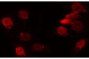 ABIN6272354 staining HuvEc by IF/ICC. (NANOGP8 抗体)