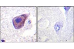 Immunohistochemistry (IHC) image for anti-Guanine Nucleotide Binding Protein (G Protein), alpha Z Polypeptide (GNaZ) (AA 1-50) antibody (ABIN1532672)
