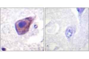 Immunohistochemistry analysis of paraffin-embedded human brain tissue, using Gz-alpha (Ab-16) Antibody. (GNaZ 抗体  (AA 1-50))