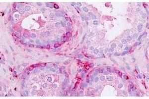Human Prostate: Formalin-Fixed, Paraffin-Embedded (FFPE) (NPDC1 抗体  (AA 189-238))