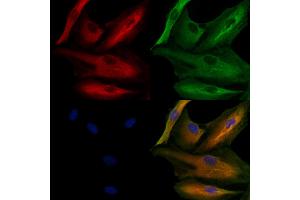ABIN6259863 and ABIN6279104 staining  cells by IF/ICC. (AKR1C4 抗体  (N-Term))