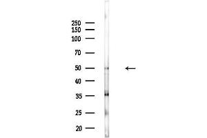 Western blot analysis of lysates from COLO205 cells(heat-shock,45 min treatment), using PP2C alpha Antibody at 1/1000 dilution.