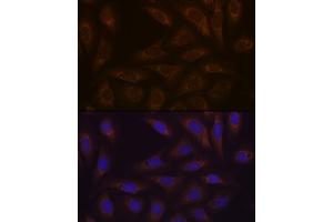 Immunofluorescence analysis of U-2 OS cells using DCP1A Rabbit mAb (ABIN7266678) at dilution of 1:100 (40x lens). (DCP1A 抗体)