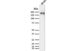 Western Blot Analysis of human brain tissue lysate using Neurofilament Mouse Recombinant Monoclonal Antibody (rNF421). (Recombinant NEFH 抗体)