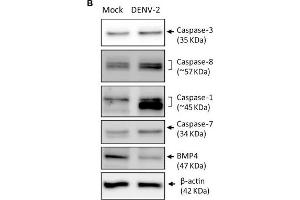 DENV-2 induces cell-damage and apoptosis pathway in HFDPCs.