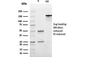 SDS-PAGE Analysis Purified E-Cadherin Mouse Monoclonal Antibody (CDH1/3256).