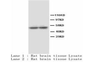 Image no. 1 for anti-Tryptophan Hydroxylase 1 (TPH1) antibody (Magnetic Particles) (ABIN1502617) (Tryptophan Hydroxylase 1 抗体  (Magnetic Particles))