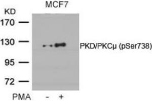 Image no. 2 for anti-Protein Kinase D1 (PRKD1) (pSer738) antibody (ABIN196754) (PKC mu 抗体  (pSer738))