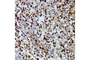 Immunohistochemistry of paraffin-embedded human appendix using DUT antibody (ABIN7266736) at dilution of 1:100 (40x lens). (Deoxyuridine Triphosphatase (DUT) (AA 89-252) 抗体)