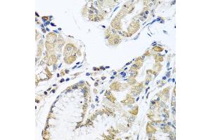 Immunohistochemistry of paraffin-embedded human stomach using IFNL3 antibody (ABIN6293714) at dilution of 1:100 (40x lens). (IL28B 抗体)