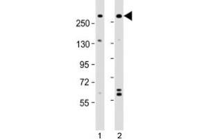 Western blot testing of human 1) A431 and 2) U-2OS cell lysate with NBAS antibody at 1:2000. (NBAS 抗体  (AA 628-661))