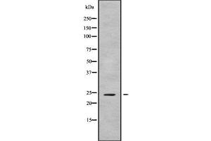 Western blot analysis FGF9 using Jurkat whole cell lysates (FGF9 抗体  (N-Term))