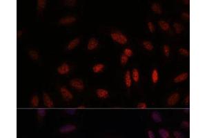 Immunofluorescence analysis of U-2 OS cells using WDR18 Polyclonal Antibody at dilution of 1:100. (WDR18 抗体)