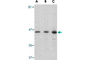 Western blot analysis of PSEN1 in human brain lysate with PSEN1 polyclonal antibody  at (A) 0. (Presenilin 1 抗体  (C-Term))