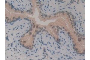 Detection of GLI3 in Mouse Vas Deferens Tissue using Polyclonal Antibody to GLI Family Zinc Finger Protein 3 (GLI3) (GLI Family Zinc Finger Protein 3 (AA 303-561) 抗体)