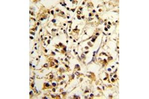 Immunohistochemistry (Paraffin-embedded Sections) (IHC (p)) image for anti-Killer Cell Immunoglobulin-Like Receptor, Two Domains, Long Cytoplasmic Tail, 4 (KIR2DL4) (AA 302-332), (C-Term) antibody (ABIN951198)