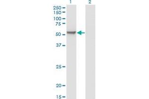 Western Blot analysis of MPP1 expression in transfected 293T cell line by MPP1 monoclonal antibody (M01), clone 1E11-1G11. (MPP1 抗体  (AA 1-466))