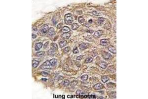 Immunohistochemistry (IHC) image for anti-Aldolase (ALD) antibody (ABIN3001589) (Aldolase 抗体)