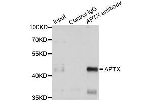 Immunoprecipitation analysis of 150ug extracts of A549 cells using 3ug APTX antibody. (Aprataxin 抗体)