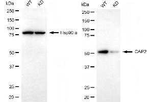 Western blotting analysis using CAP2 antibody (ABIN7797526).