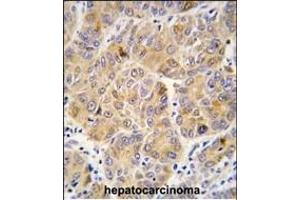 Immunohistochemistry (Paraffin-embedded Sections) (IHC (p)) image for anti-Aldehyde Dehydrogenase 9 Family, Member A1 (ALDH9A1) (AA 445-477), (C-Term) antibody (ABIN392321)