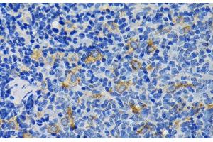 Immunohistochemistry of paraffin-embedded Rat spleen using IQGAP1 Polyclonal Antibody at dilution of 1:200 (40x lens). (IQGAP1 抗体)