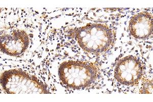 Detection of RNASE3 in Human Rectum Tissue using Polyclonal Antibody to Ribonuclease A3 (RNASE3) (RNASE3 抗体  (AA 30-154))
